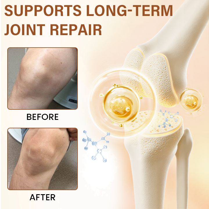 🦵🏻 CVREOZ® MagniBee Joint Relief Spray 🐝LIMITED OFFER 60% OFF