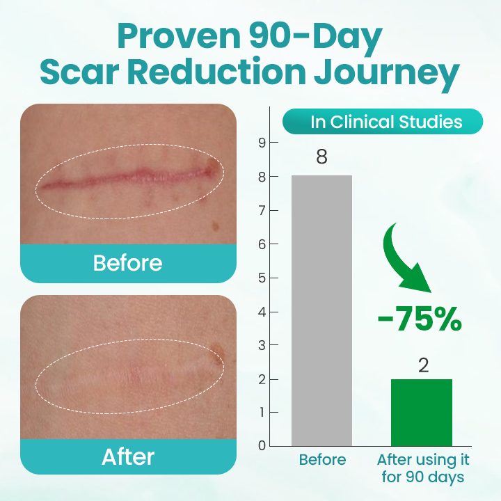 ⏰ Last Day Promotion 60% OFF 🔥 Cvreoz® EliteAloe ScarSolve Spray