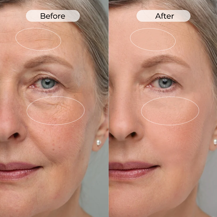 🔥NEW HOT SALE🔥 60% OFF - TLOPA® TightShift Precision Contour & Firming Serum