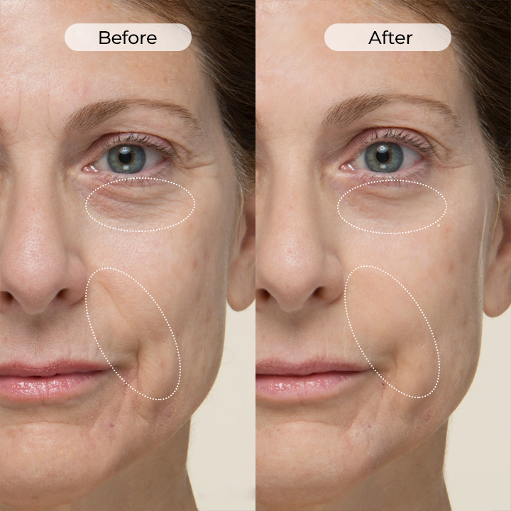🔥NEW HOT SALE🔥 60% OFF - TLOPA® TightShift Precision Contour & Firming Serum