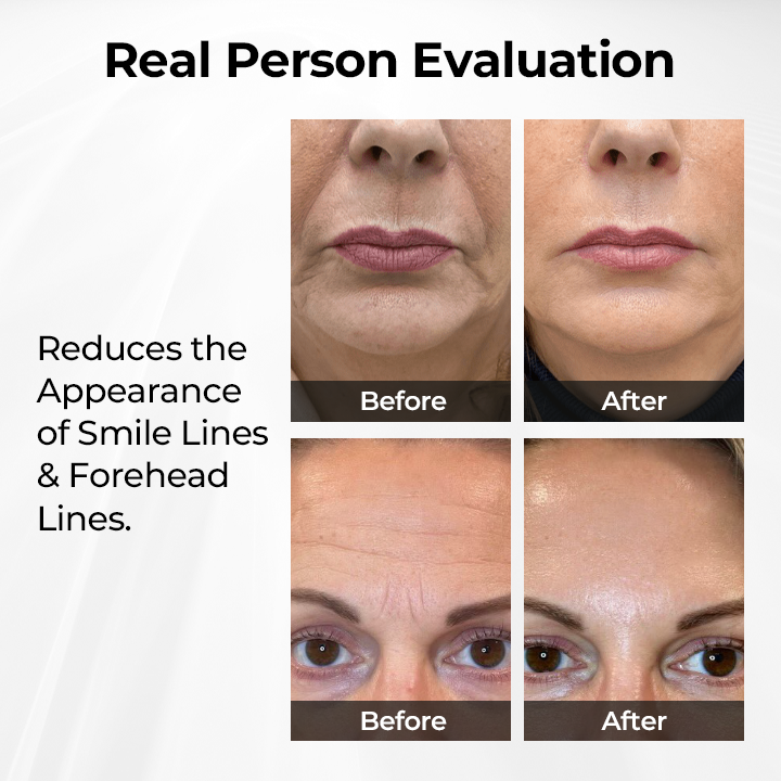 🔥NEW HOT SALE🔥 60% OFF - TLOPA® TightShift Precision Contour & Firming Serum