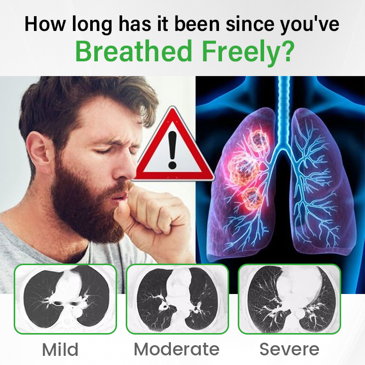 ⏰Last Day Promotion: 60% OFF🔥 Cvreoz® Pulmovia Quercetin Lung Detox Inhaler