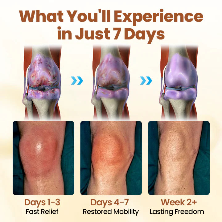 đ„Last Deal: 60% Offđ„ CVREOZÂź Premium Curcumin Pain Relief Gel