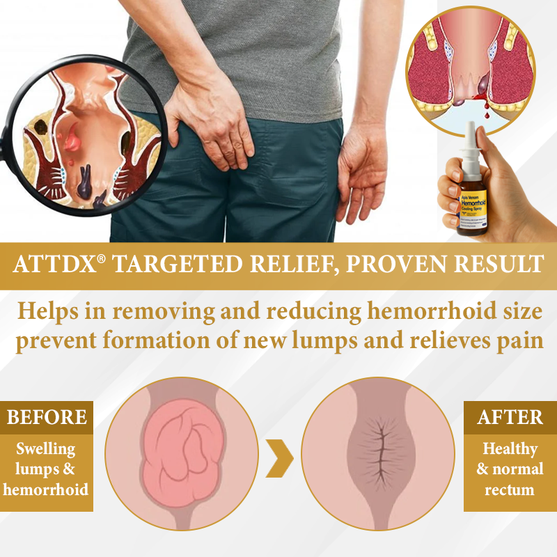 đ„ Sale up to 60% - Order NOW! đ„ CvreozÂź Apis Venom Hemorrhoid Cooling Spray