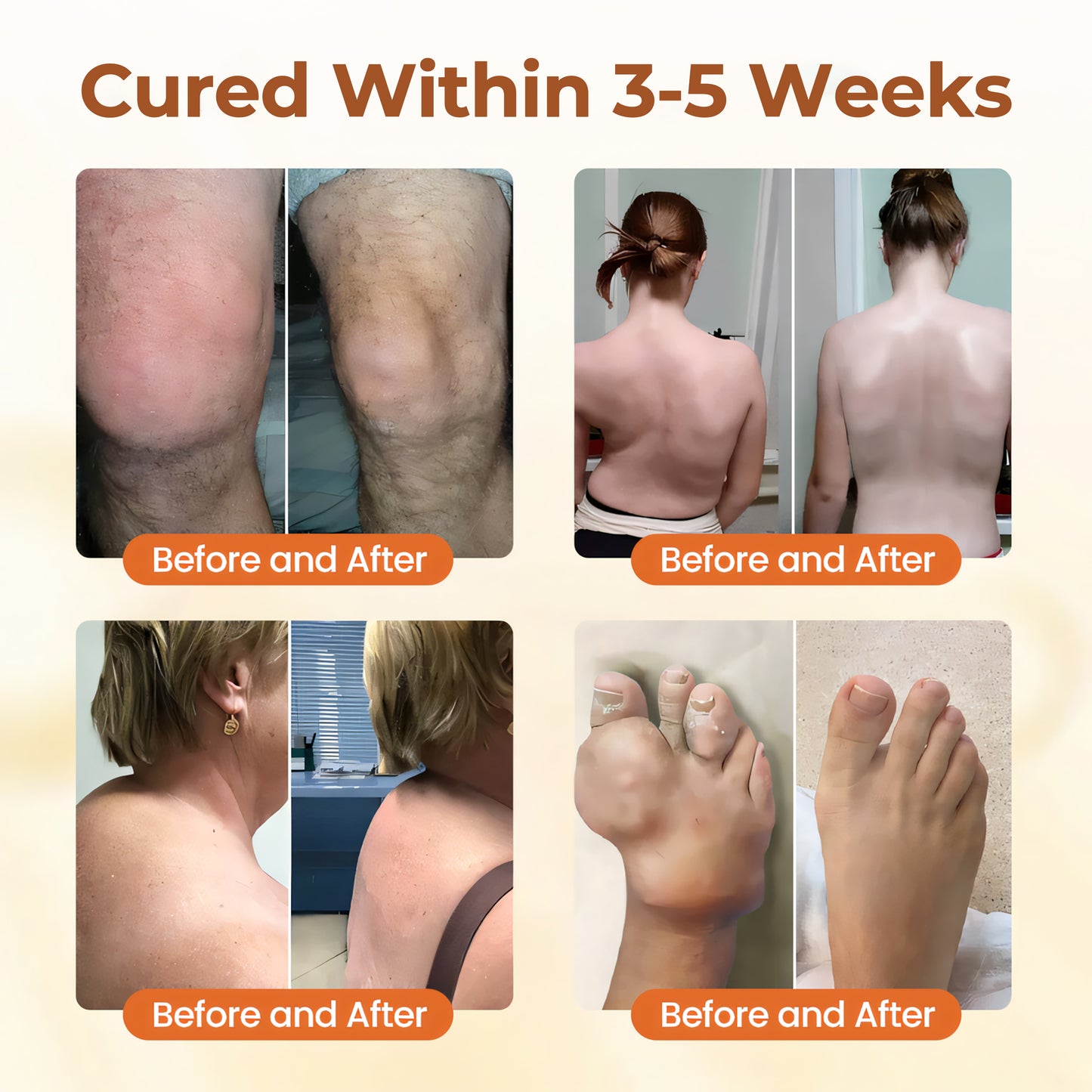 đ„Last Deal: 60% Offđ„ CVREOZÂź Premium Curcumin Pain Relief Gel