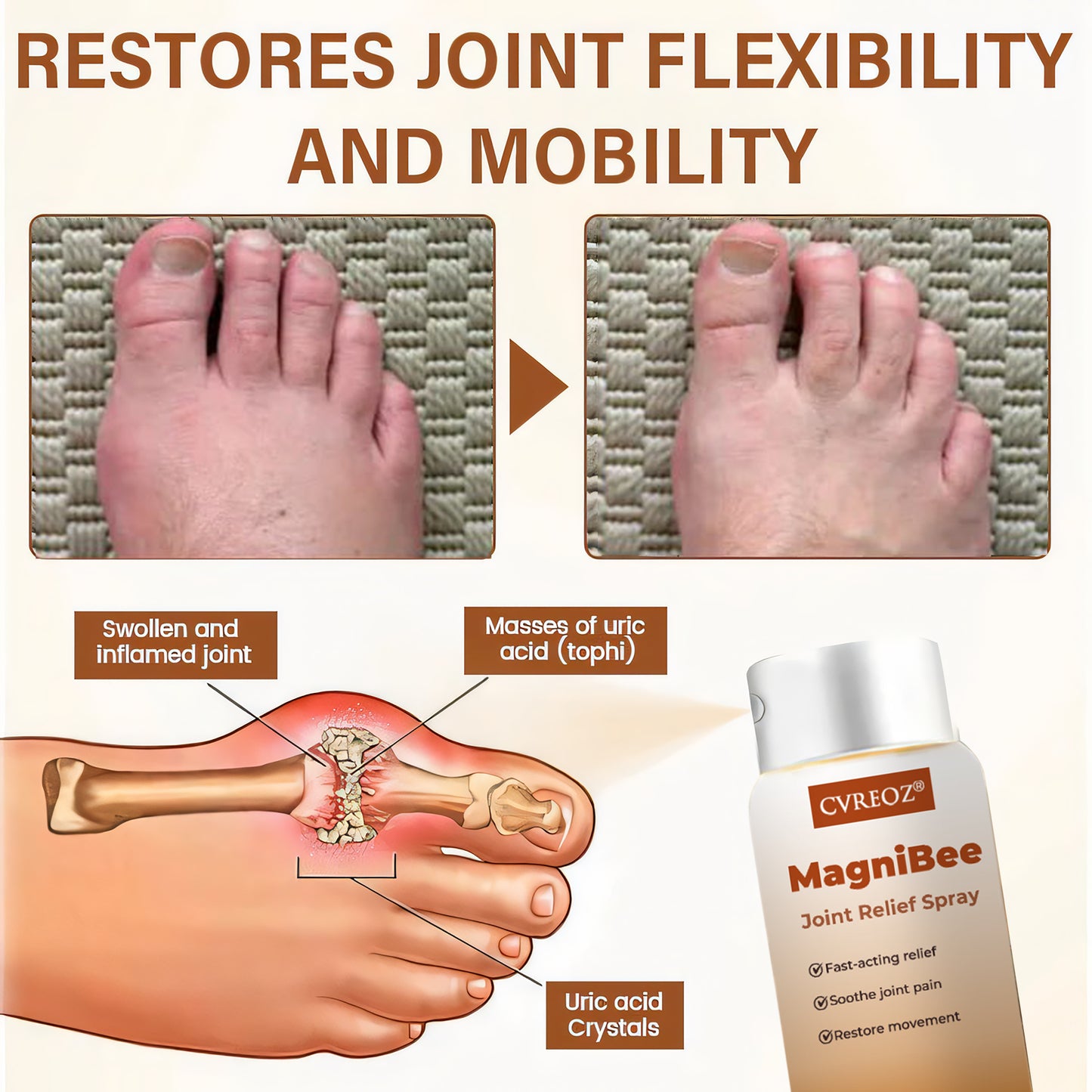 🦵🏻 CVREOZ® MagniBee Joint Relief Spray 🐝LIMITED OFFER 60% OFF