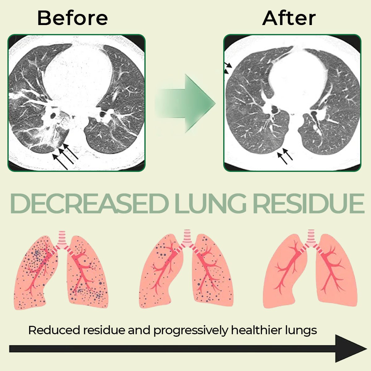 CVREOZ® Lung Cleanse Herbal Purifier Inhaler Pen