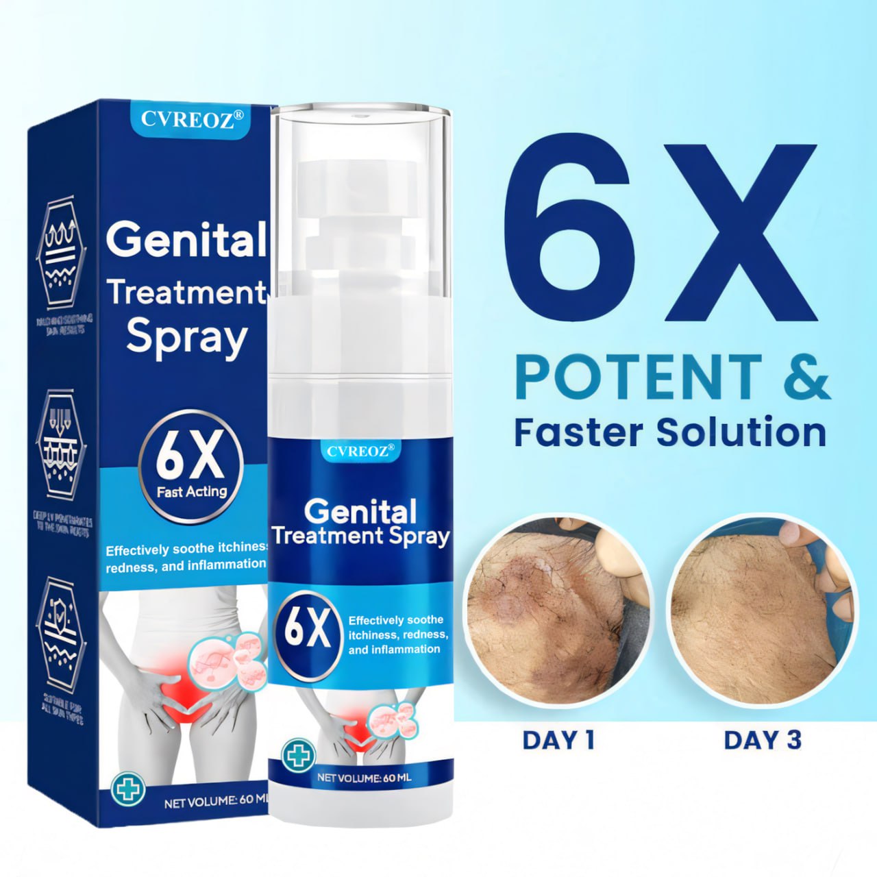 đ„2025 LIMITED 60% OFFđ„ CvreozÂź Genital Treatment Spray