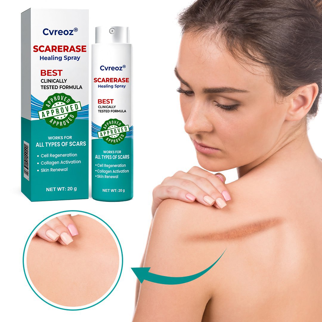 ⏰ Last Day Promotion 60% OFF 🔥 Cvreoz® EliteAloe ScarSolve Spray