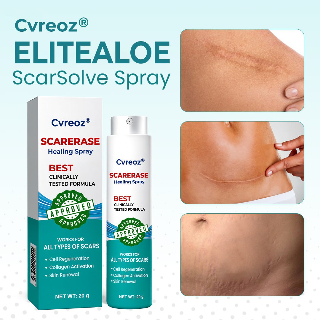 ⏰ Last Day Promotion 60% OFF 🔥 Cvreoz® EliteAloe ScarSolve Spray