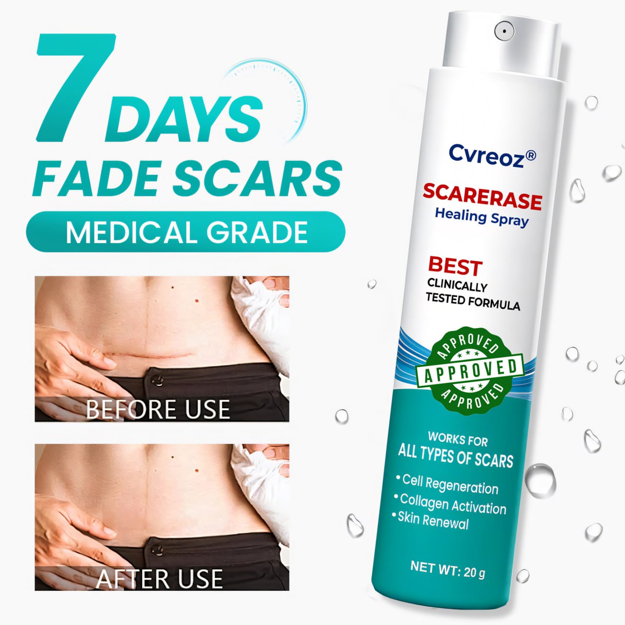 ⏰ Last Day Promotion 60% OFF 🔥 Cvreoz® EliteAloe ScarSolve Spray