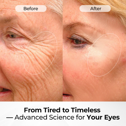 🔥 LIMITED OFFER: 60% OFF 🔥 Cvreoz® TightShift Precision Contour & Firming Serum