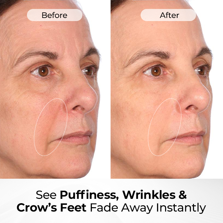 🔥 LIMITED OFFER: 60% OFF 🔥 Cvreoz® TightShift Precision Contour & Firming Serum