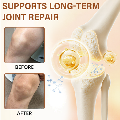 🦵🏻 CVREOZ® MagniBee Joint Relief Spray 🐝LIMITED OFFER 60% OFF