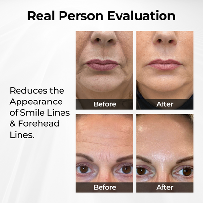 🔥 LIMITED OFFER: 60% OFF 🔥 Cvreoz® TightShift Precision Contour & Firming Serum