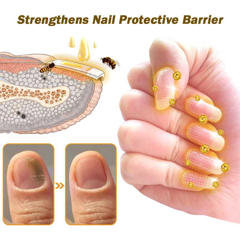 CVREOZ™ Nail Fungus Bee Venom Treatment Serum 🔥 Limited-time offer 60% 🔥