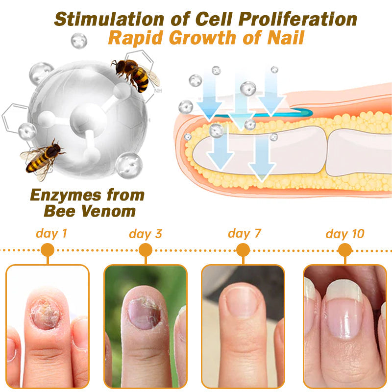 CVREOZ™ Nail Fungus Bee Venom Treatment Serum 🔥 Limited-time offer 60% 🔥