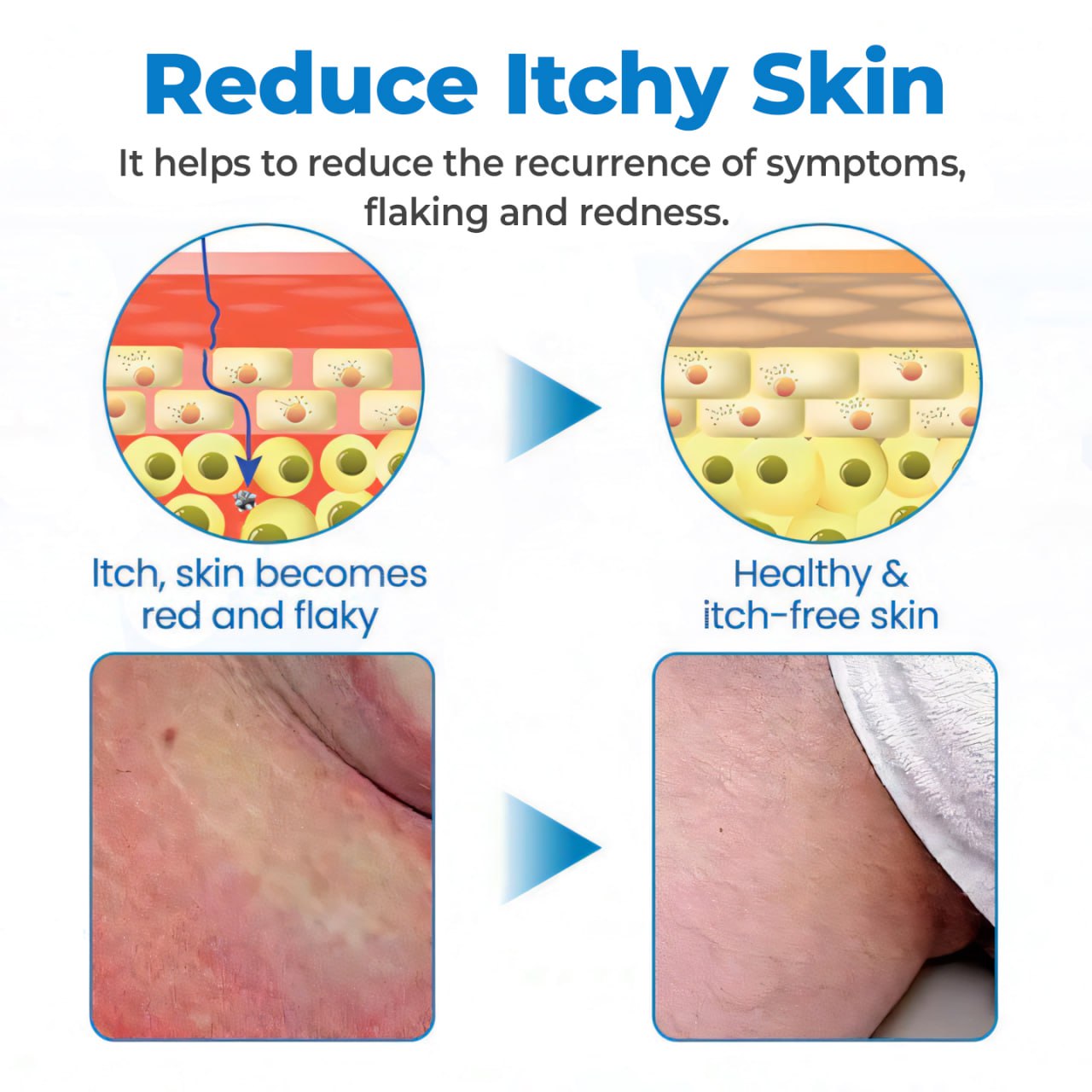 🔥Last Deal: 60% Off🔥 CVREOZ® Fast-Acting & Natural GentX Relief Cream