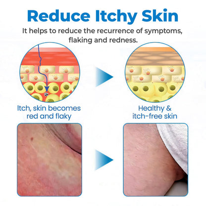 🔥Last Deal: 60% Off🔥 CVREOZ® Fast-Acting & Natural GentX Relief Cream