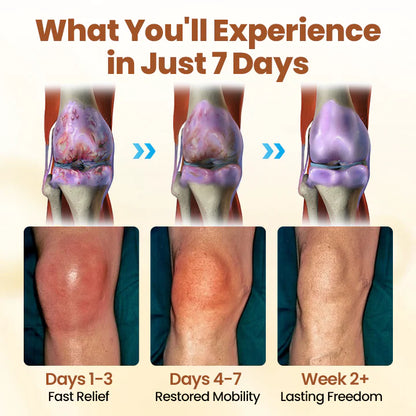 🔥Last Deal: 60% Off🔥 CVREOZ® Premium Curcumin Pain Relief Gel
