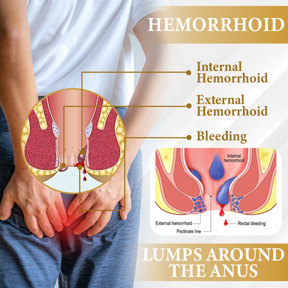 🔥 Sale up to 60% - Order NOW! 🔥 Cvreoz® Apis Venom Hemorrhoid Cooling Spray