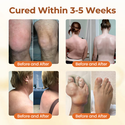 🔥Last Deal: 60% Off🔥 CVREOZ® Premium Curcumin Pain Relief Gel